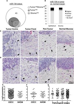 MicroRNA-138 Abates Fibroblast Motility With Effect on Invasion of Adjacent Cancer Cells